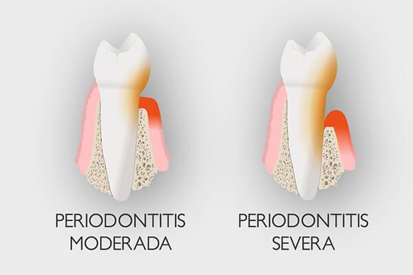 Diseño de la sonrisa