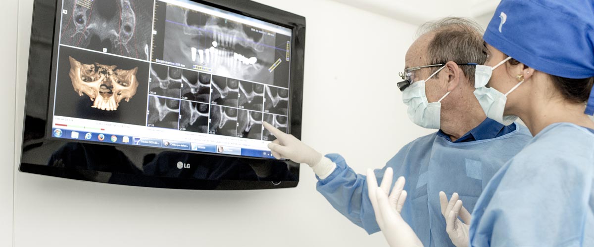 15 Preguntas sobre implantes dentales - Especialistas en implantología