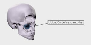 Elevación del seno maxilar - Ubicación del seno maxilar