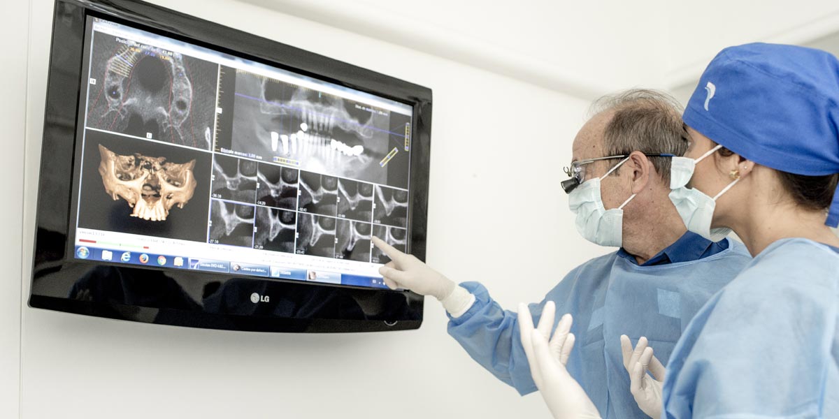 implante dental - Periodontium, especialistas en implantes dentales