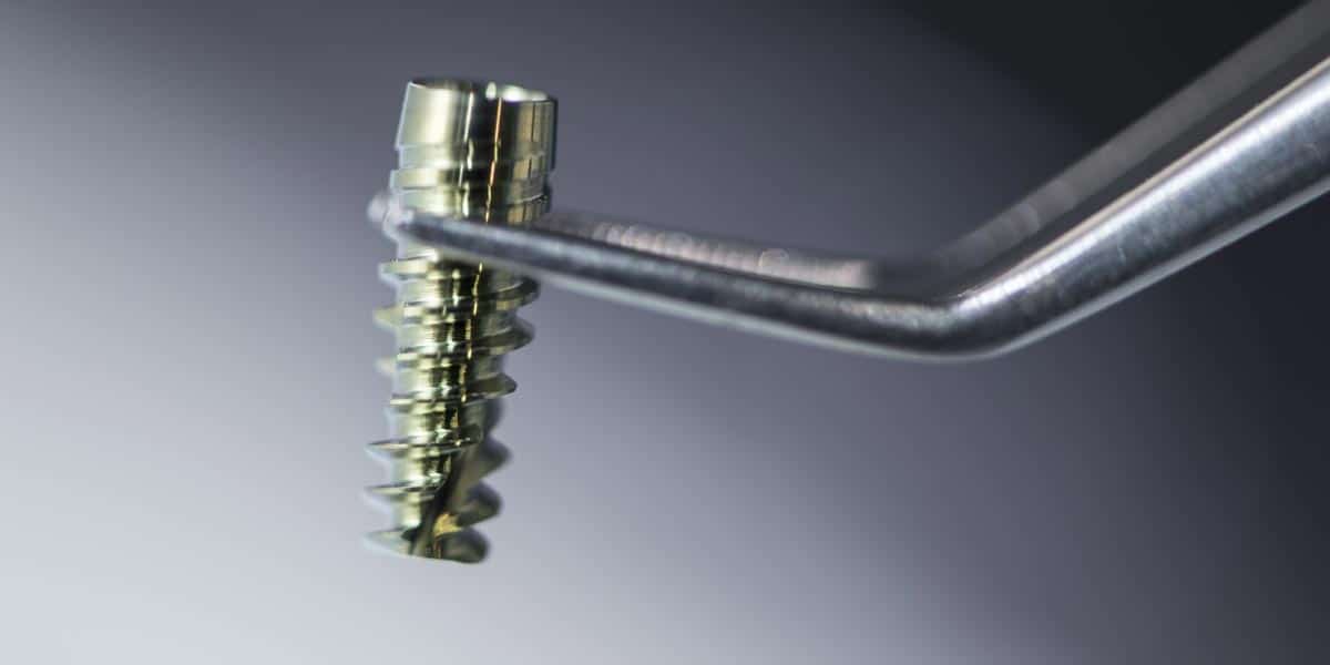 Elegir al mejor implantólogo - Materiales premium