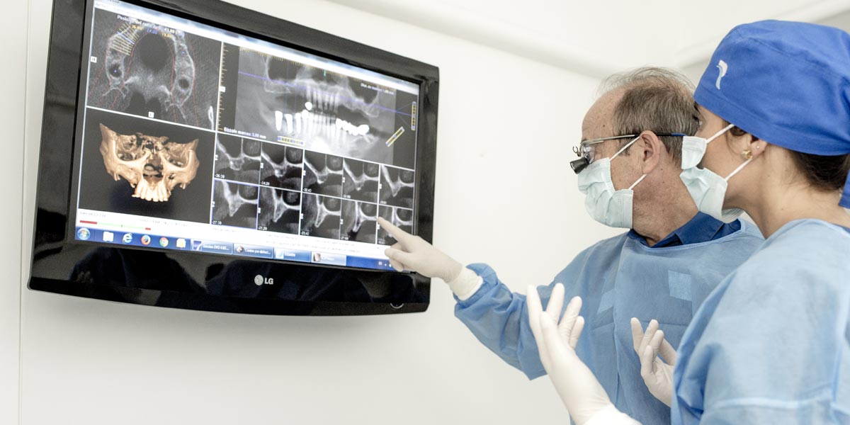 Elegir al mejor implantólogo - Tecnología de vanguardia