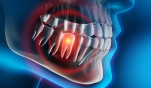 Urgencia dental - dolor agudo de dientes