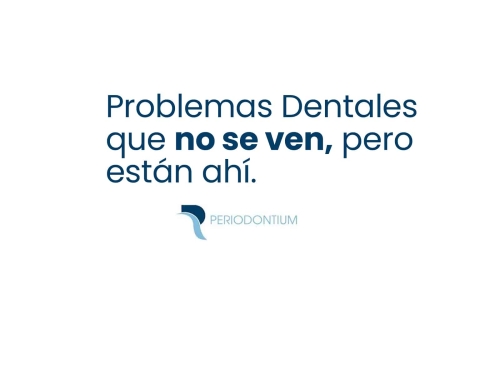 Problemas dentales que no se ven y están