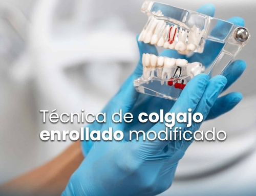 ¿Qué es la técnica de colgajo enrollado modificado?