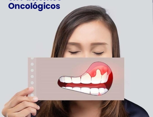 Problemas Dentales y de Periodoncia en Pacientes Oncológicos