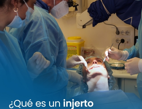 ¿Por qué se pierde hueso dental?