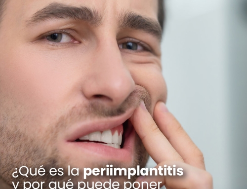 ¿Qué es la periimplantitis?